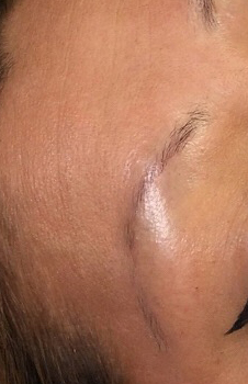 Microblading