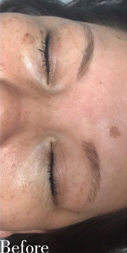 Microblading