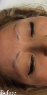 Microblading