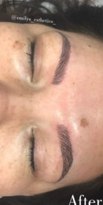 Microblading