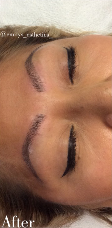 Microblading